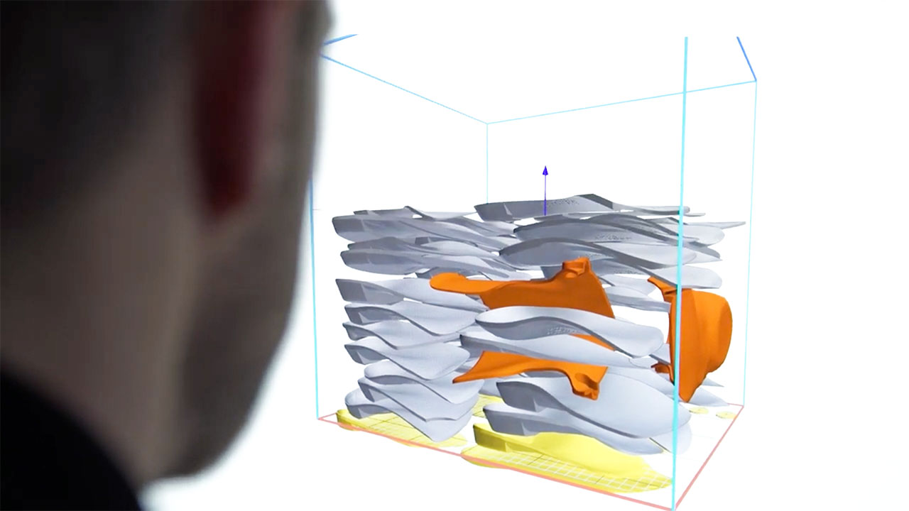 3D Printing iOrthotics Technology