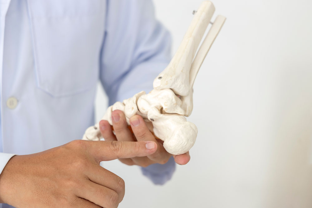 Plantar Fasciitis