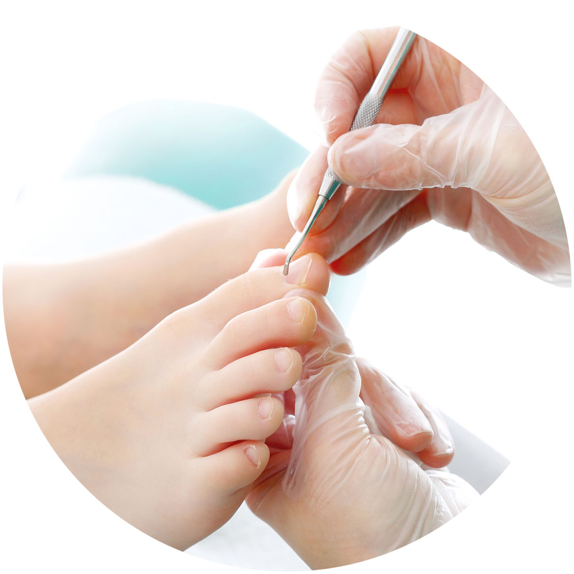 Toenail Care Lismore