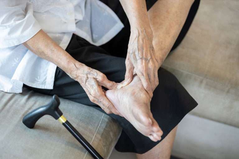osteoarthritis